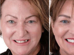 The Burkitt Center For Comprehensive Dentistry