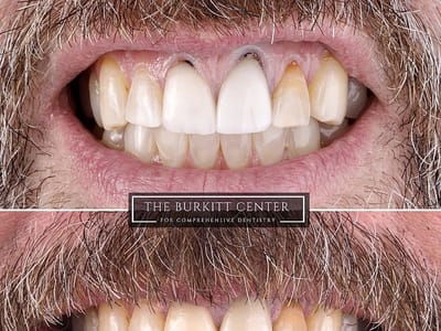 The Burkitt Center For Comprehensive Dentistry