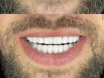 The Center for Advanced Dentistry