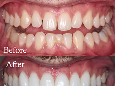 The Center For Cosmetic and Family Dentistry