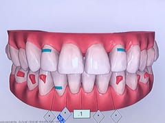 The Dental Method | Dentist In Plano