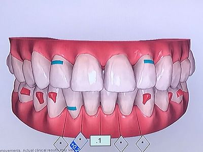 The Dental Method | Dentist In Plano