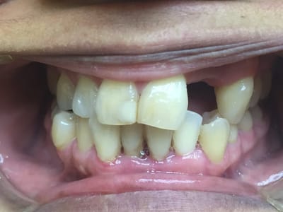 The Gentle Dentist of Jackson Heights - Dr. Amit Sood, DDS