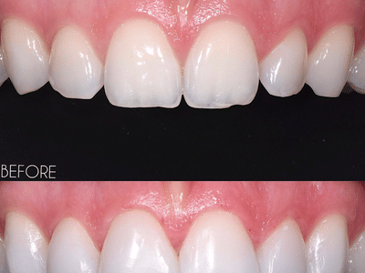 The Grand Prairie Dentist- Implants and Cosmetic Dentistry