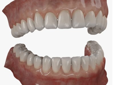 The Grand Prairie Dentist- Implants and Cosmetic Dentistry