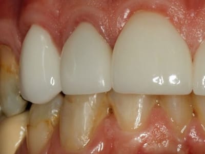 The Pasadena Dentist: Michael Nugent DDS