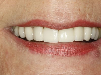 The Pasadena Dentist: Michael Nugent DDS