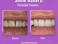 Thomas Smile Designs