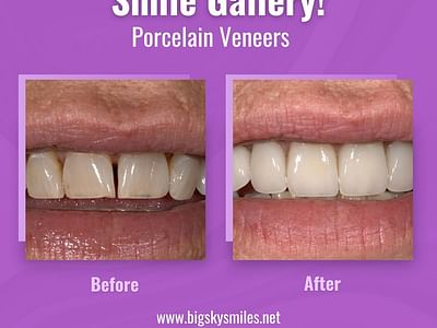 Thomas Smile Designs