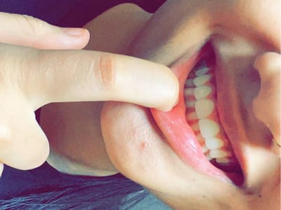 Thomas Smile Designs