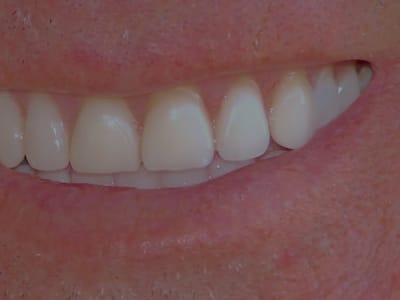 Tiger Smile Family Dentistry - Baton Rouge Dentist Office