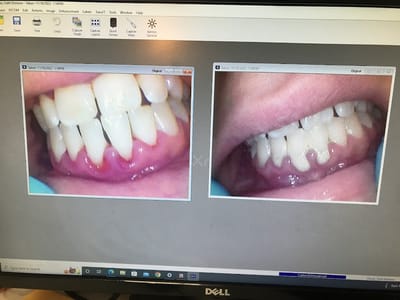 Todays Dental @ Greenville