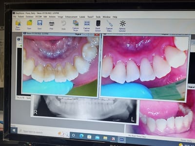 Todays Dental @ Greenville