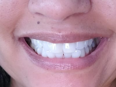 Triangle Family Dentistry