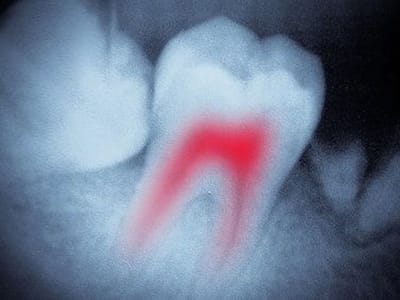 Trovato Family Laser Dentistry