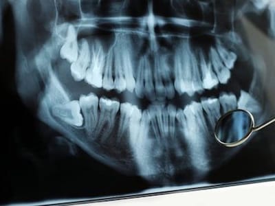 Trovato Family Laser Dentistry