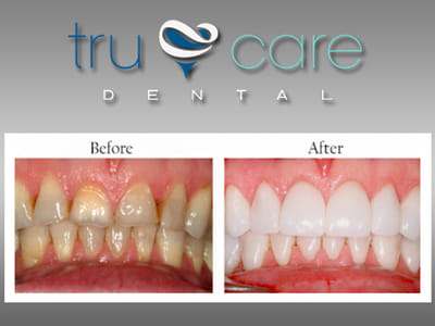 TruCare Dental
