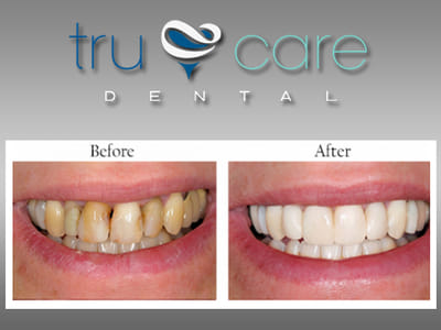TruCare Dental
