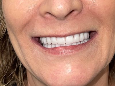 U Smile Family Dentistry - Mesa