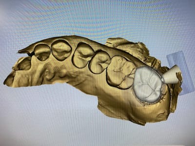 Union Dental Center: Family & Emergency Dentistry