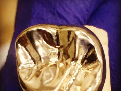 Union Smiles Family & Cosmetic Dentistry - Dr. Umut Caglar, D.D.S.