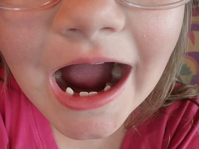 Valparaiso Family Dentistry