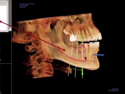 Vermillion Dental Health: Zachary Kopf DDS, Gary Prosser DDS, Blake Kopf DDS