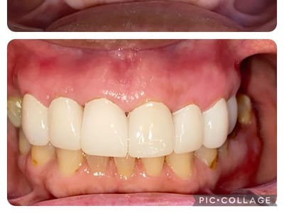 Vernon Family Dental