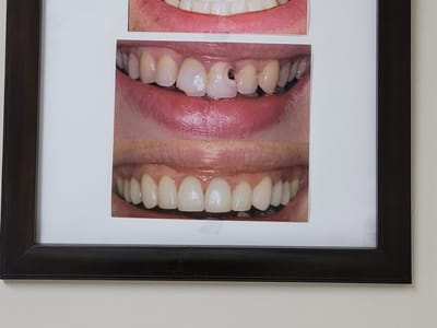 Vernon Family Dental