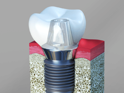 Victoria Place Dental Center