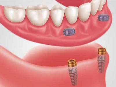 Village Family Dental - Dentist in Dallas, Duncanville