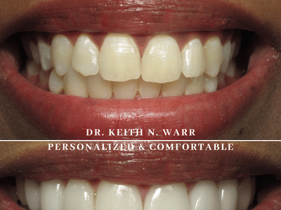 Warr Dental