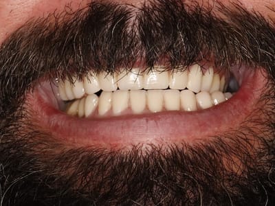 Webber Comprehensive Dentistry