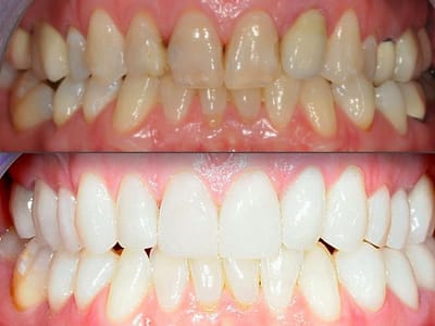 Westchester Dental Care - Mount Kisco NY Dentist