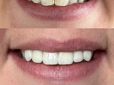 White Smiles Family Dental