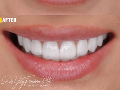 Whole Dental Design - Cosmetic Dentist