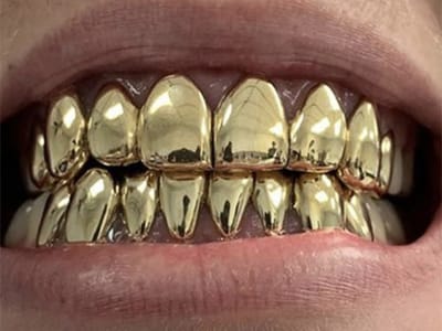 WIllow Creek Dental Center