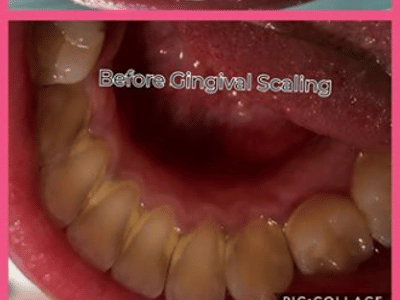 Xuewen Shawn Cui DDS