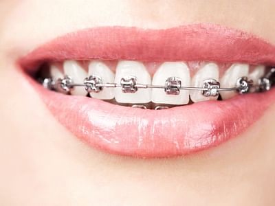 Young Family Dental Riverton