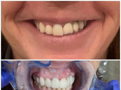 Your Dentistry of Morgan Hill