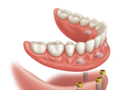 Zealous Dental Dayton