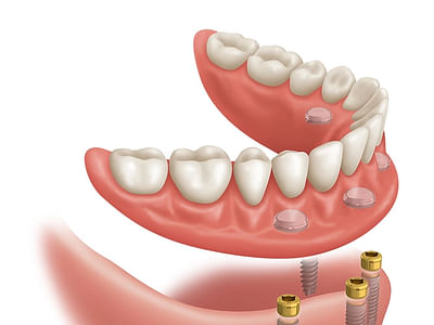Zealous Dental Dayton